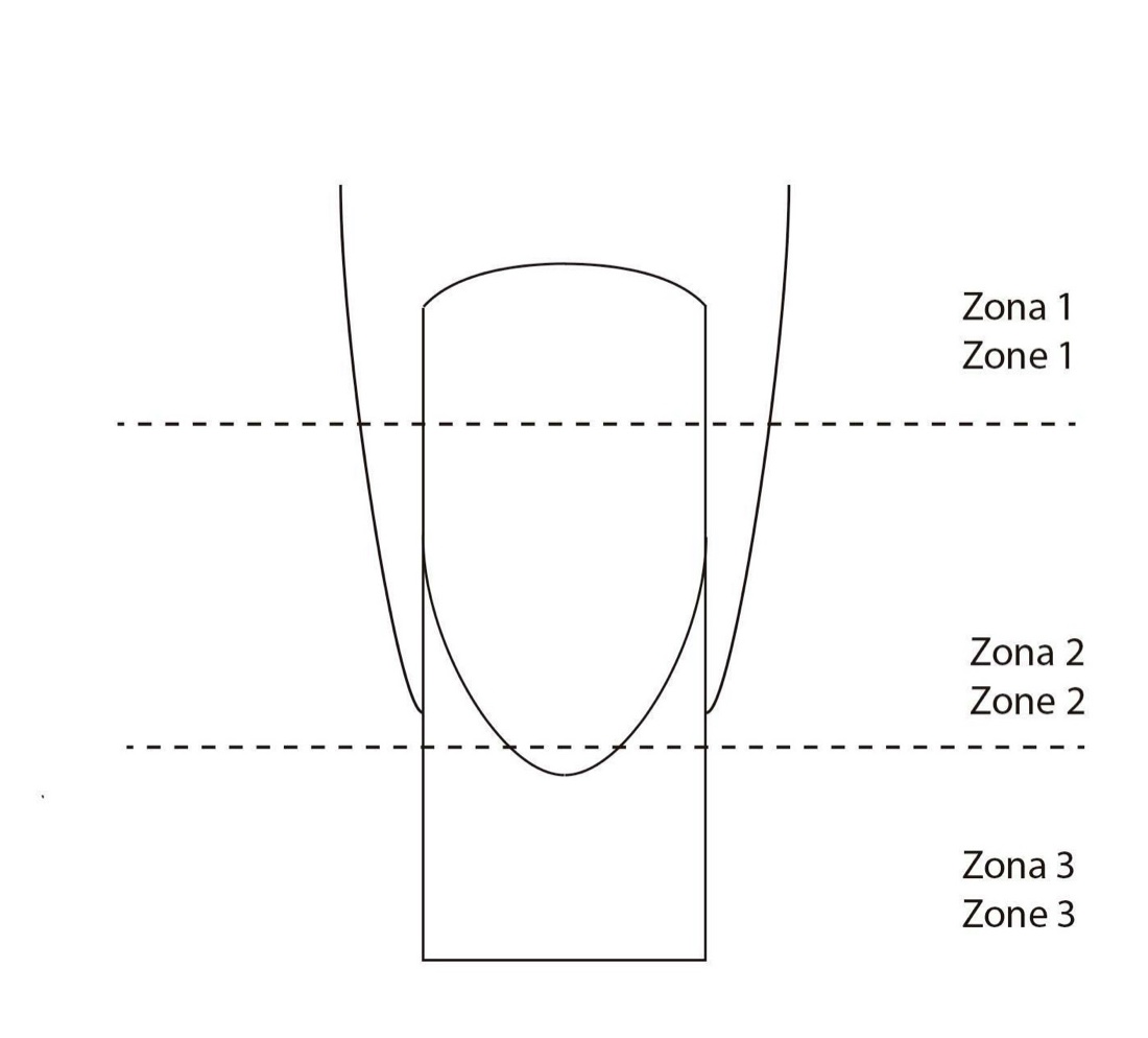 Diagram of the nail zones